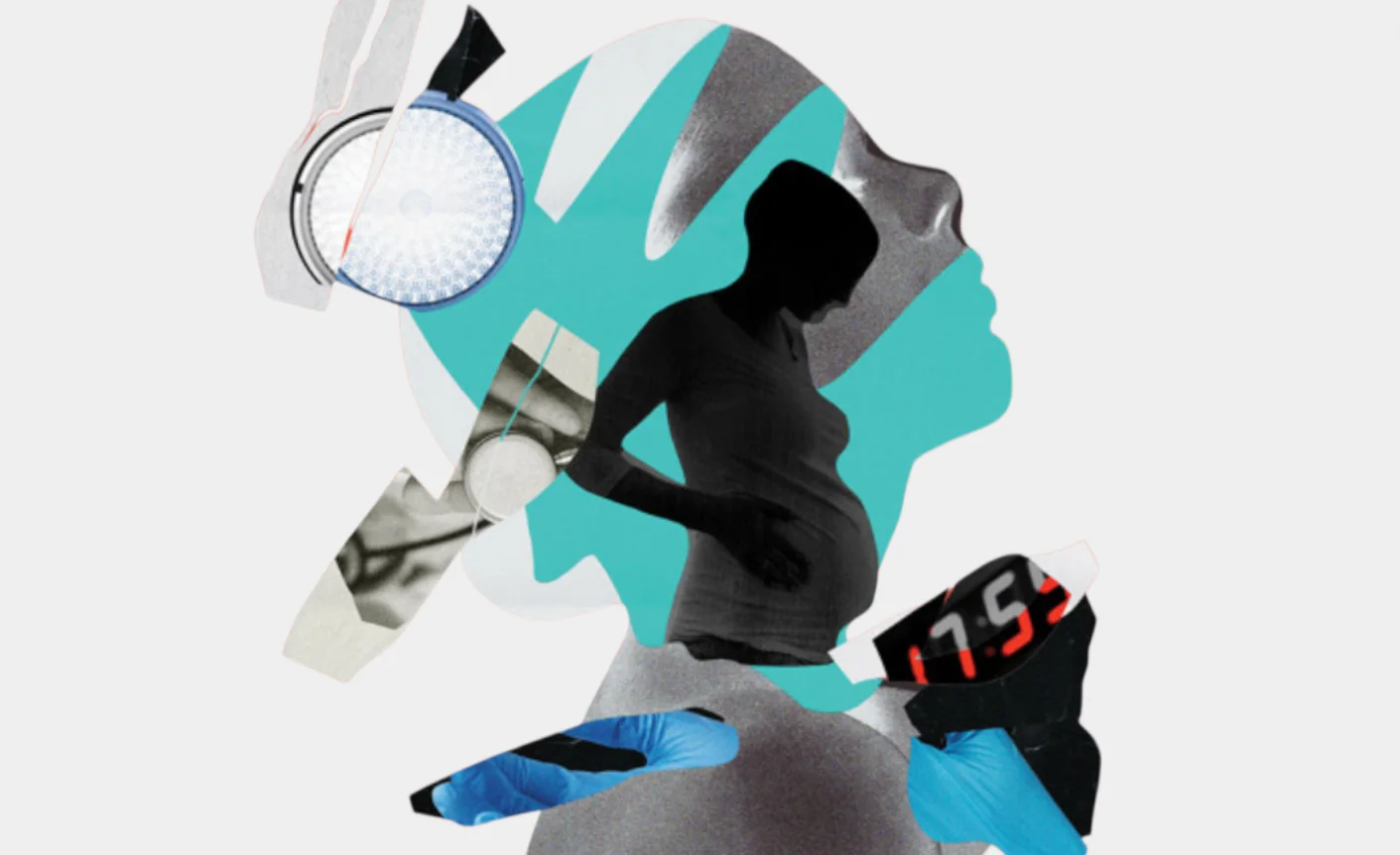 Недбалість лікарів-гінекологів, які роблять операцію