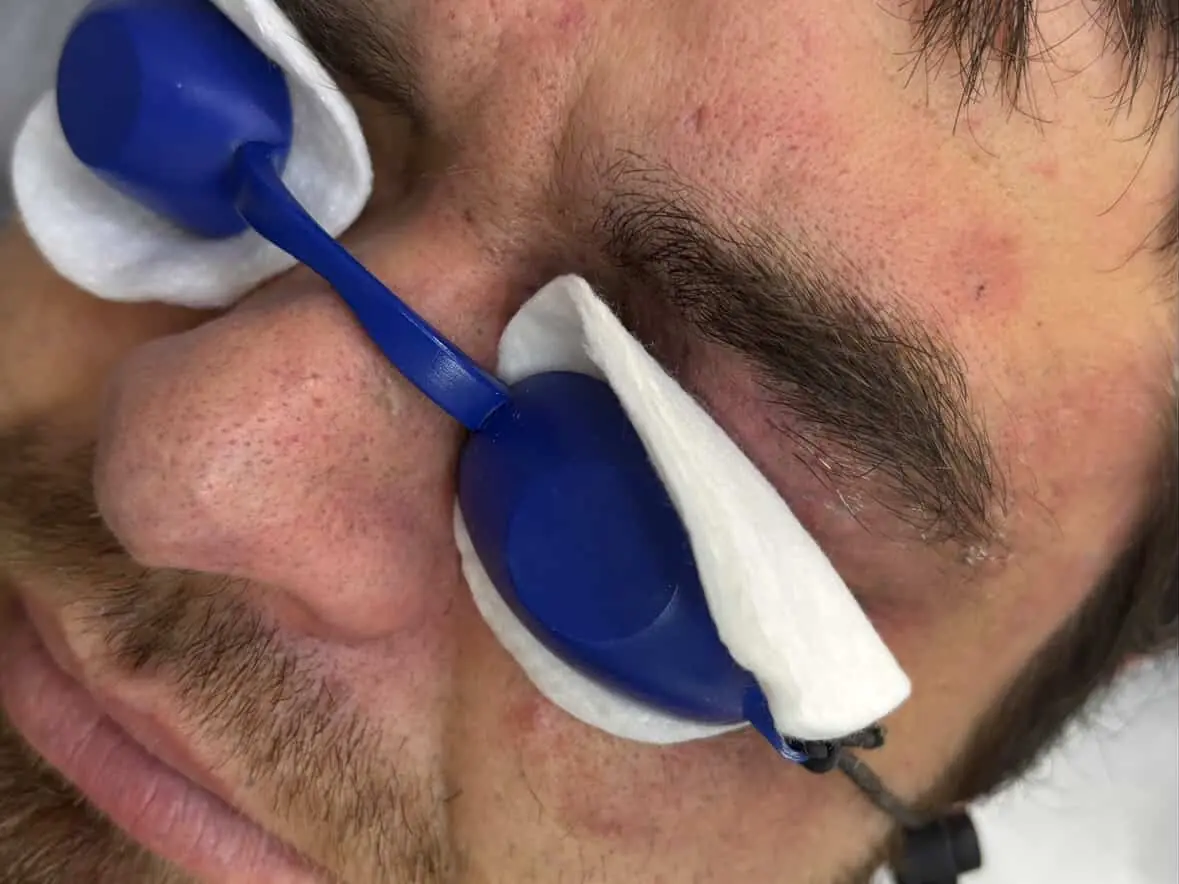 rezulʹtat vydalennya slіdіv vіd porokhu