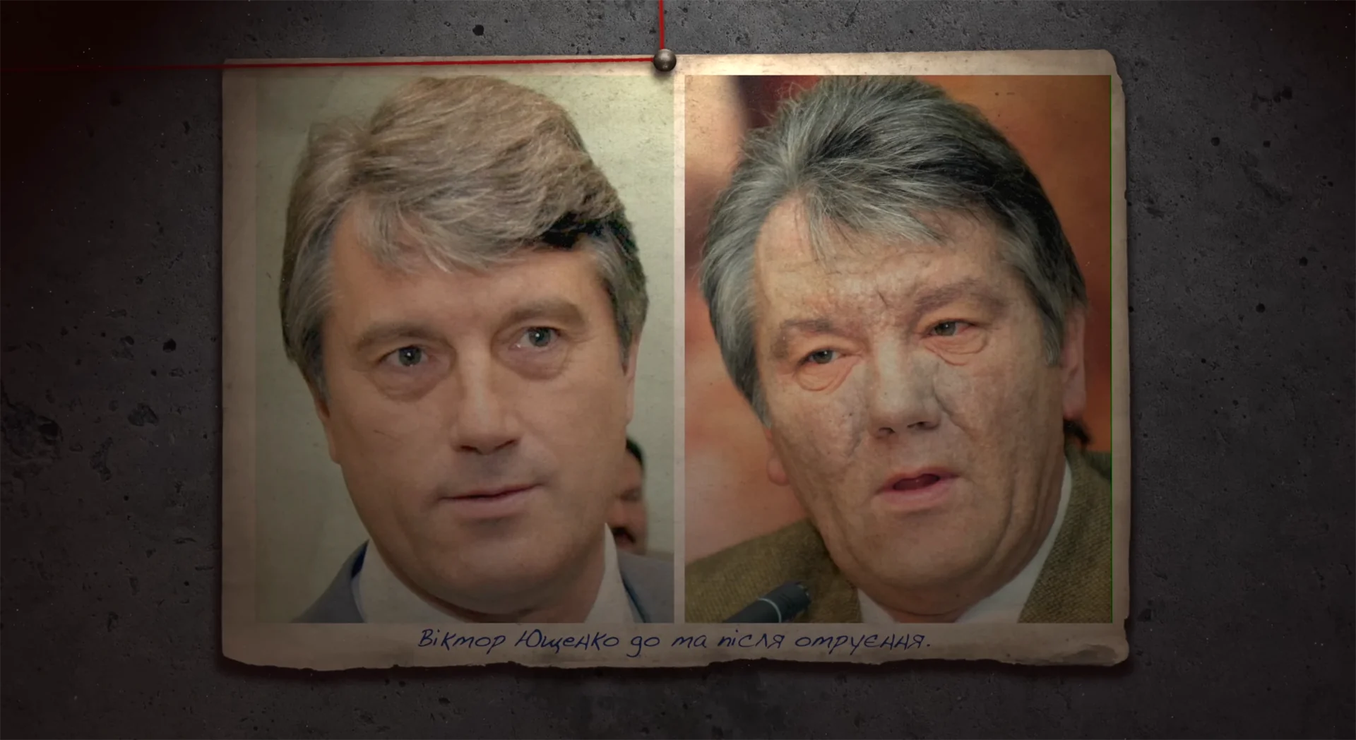 viktor yushchenko do ta pislya otruyennya Віктор Ющенко до та після отруєння