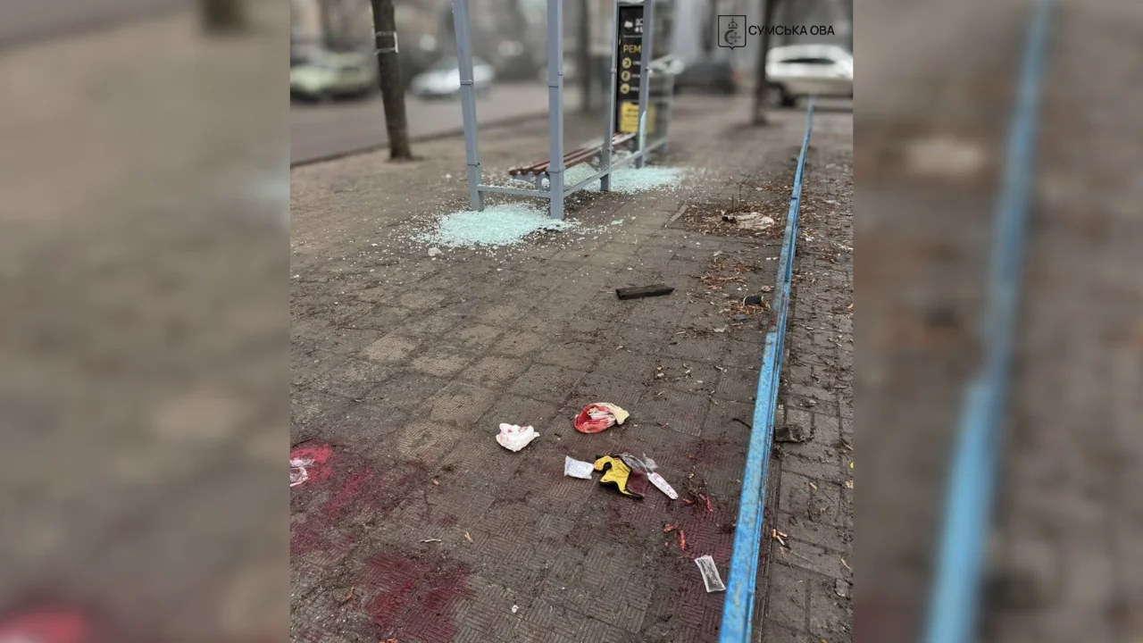 Зупинка в Сумах де був поранених хлопець